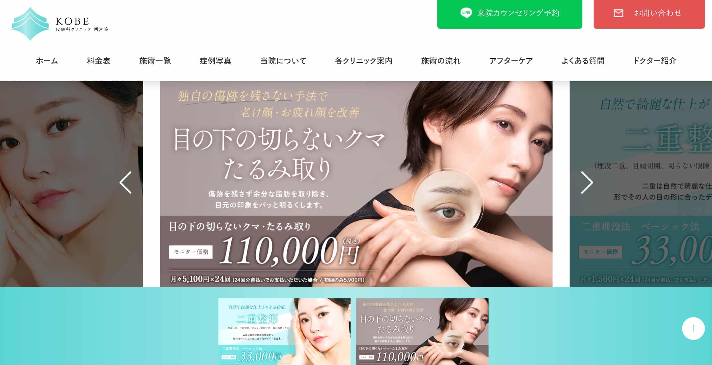 神戸でエラボトックスが安い上手いKOBE皮膚科クリニック神戸東灘院