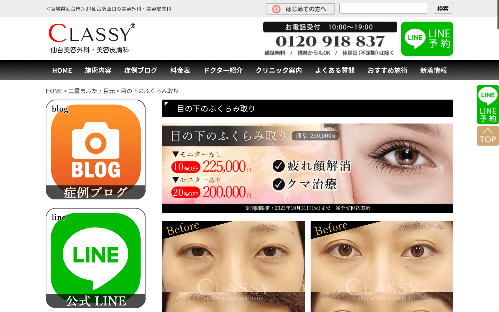 仙台市内でクマ取り治療が安くて名医がいる人気のCLASSY仙台美容外科・美容皮膚科